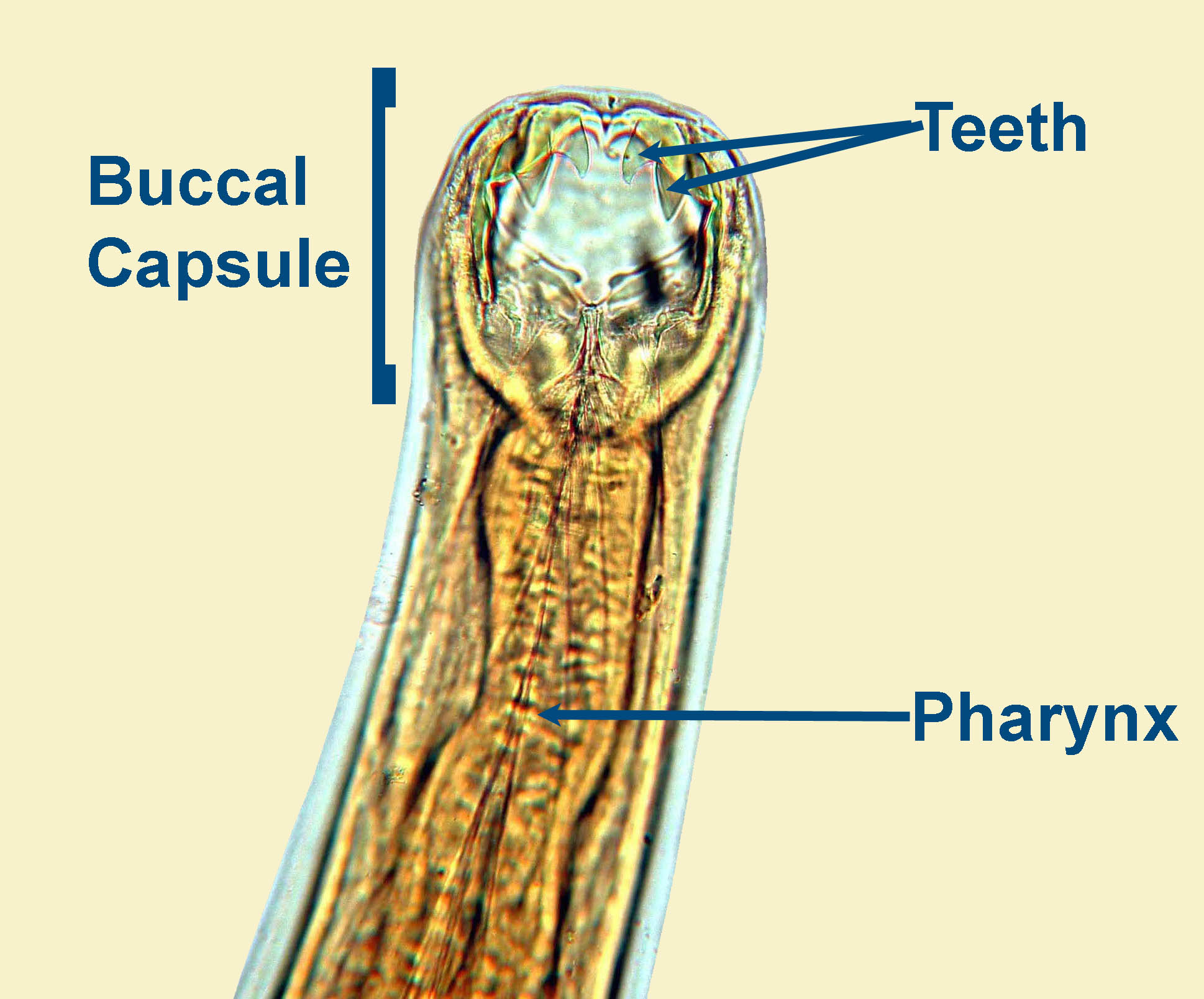 ancylostoma duodenale morphology