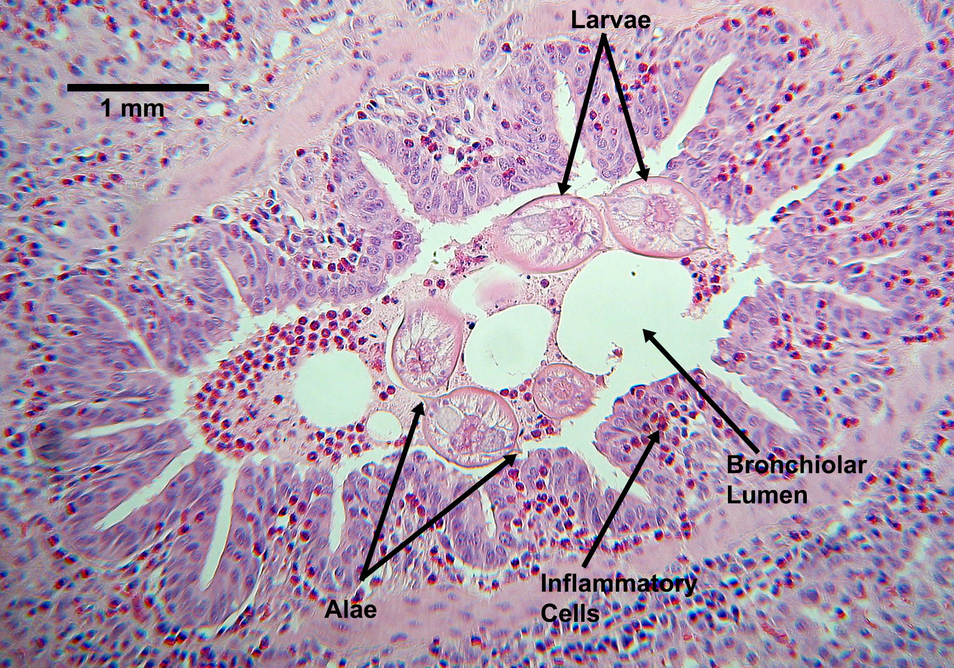 ascarid-larvae-migrating-2021.jpg