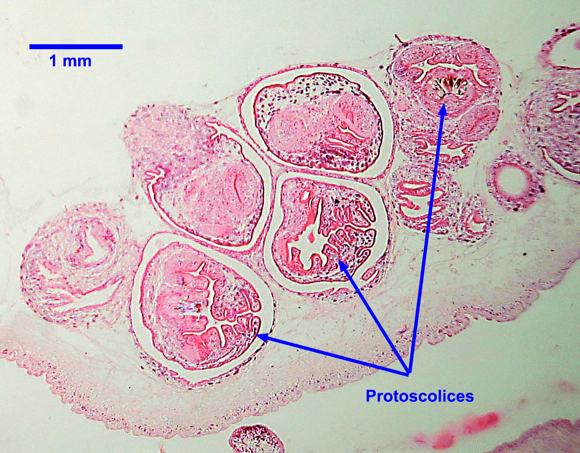 coenurus-histo-2021.jpg