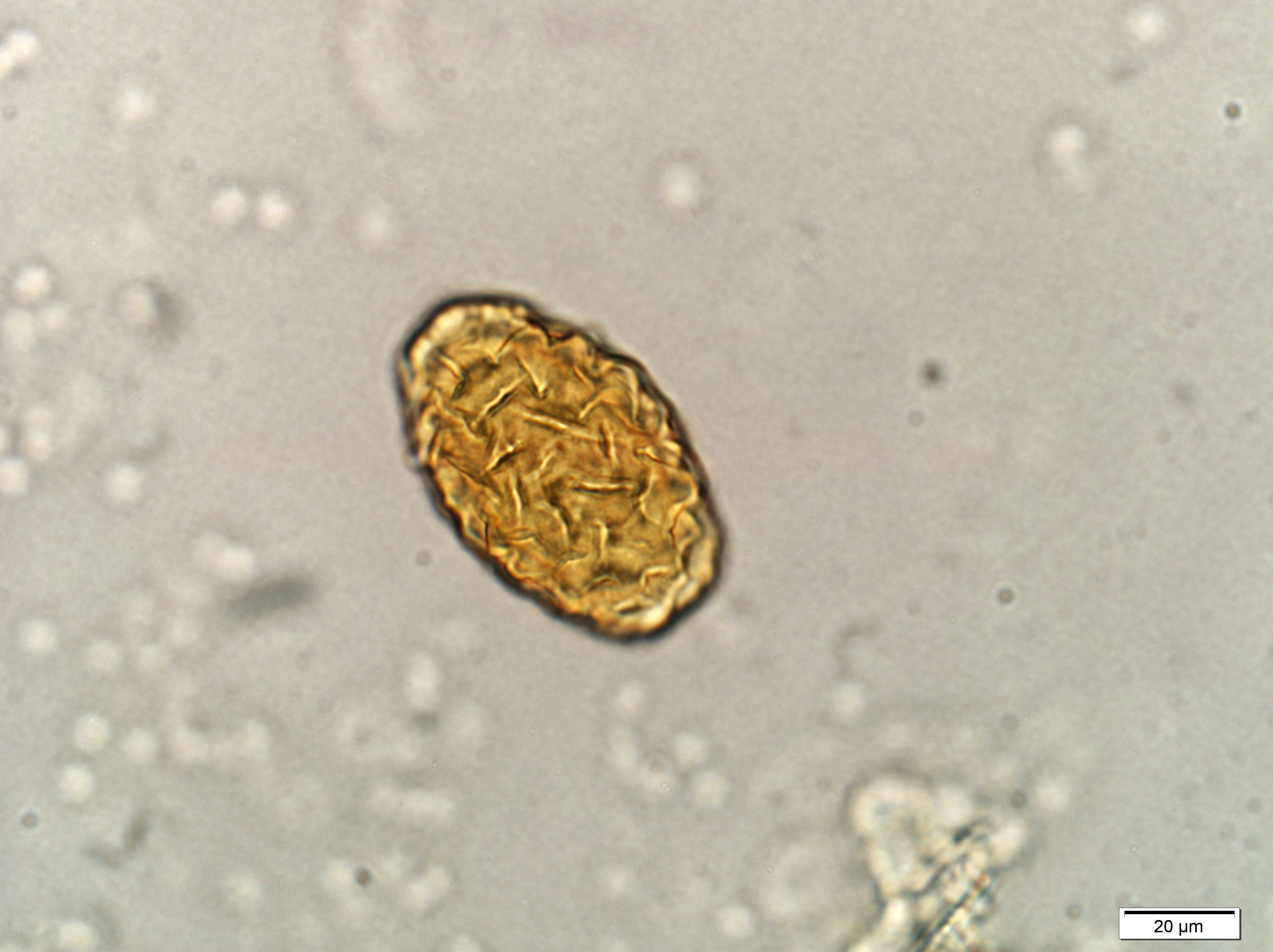 dioctophyma-egg-pitted-shell-2021.jpg
