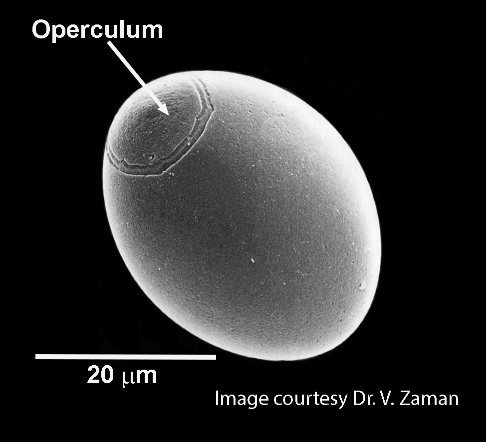 diphylobothrium-egg-sem-2021.jpg