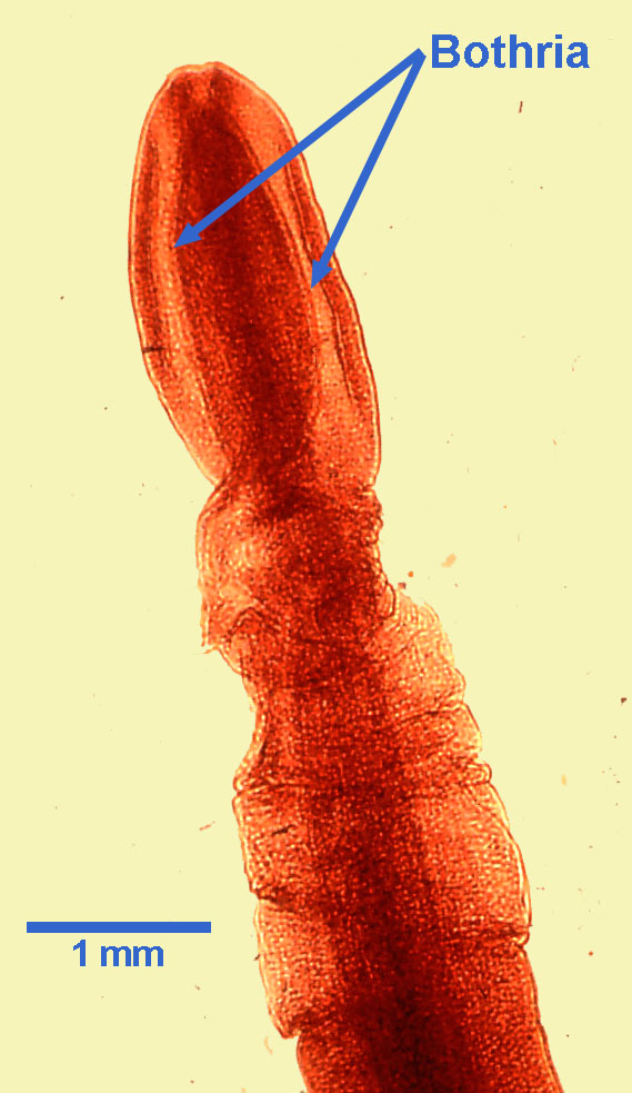 diphylobothrium-scolex-scan-2021.jpg