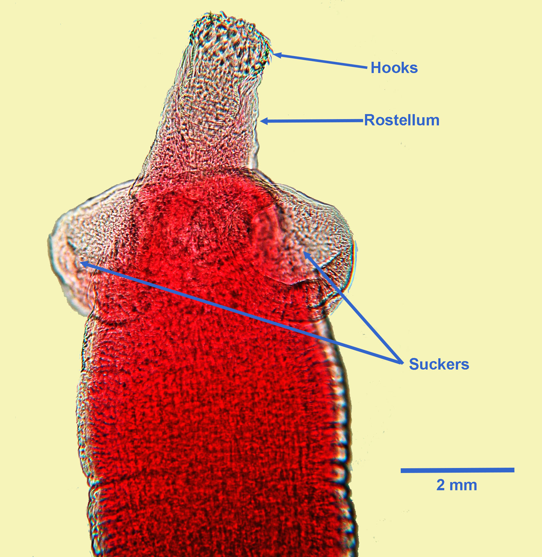 taenia solium scolex parts