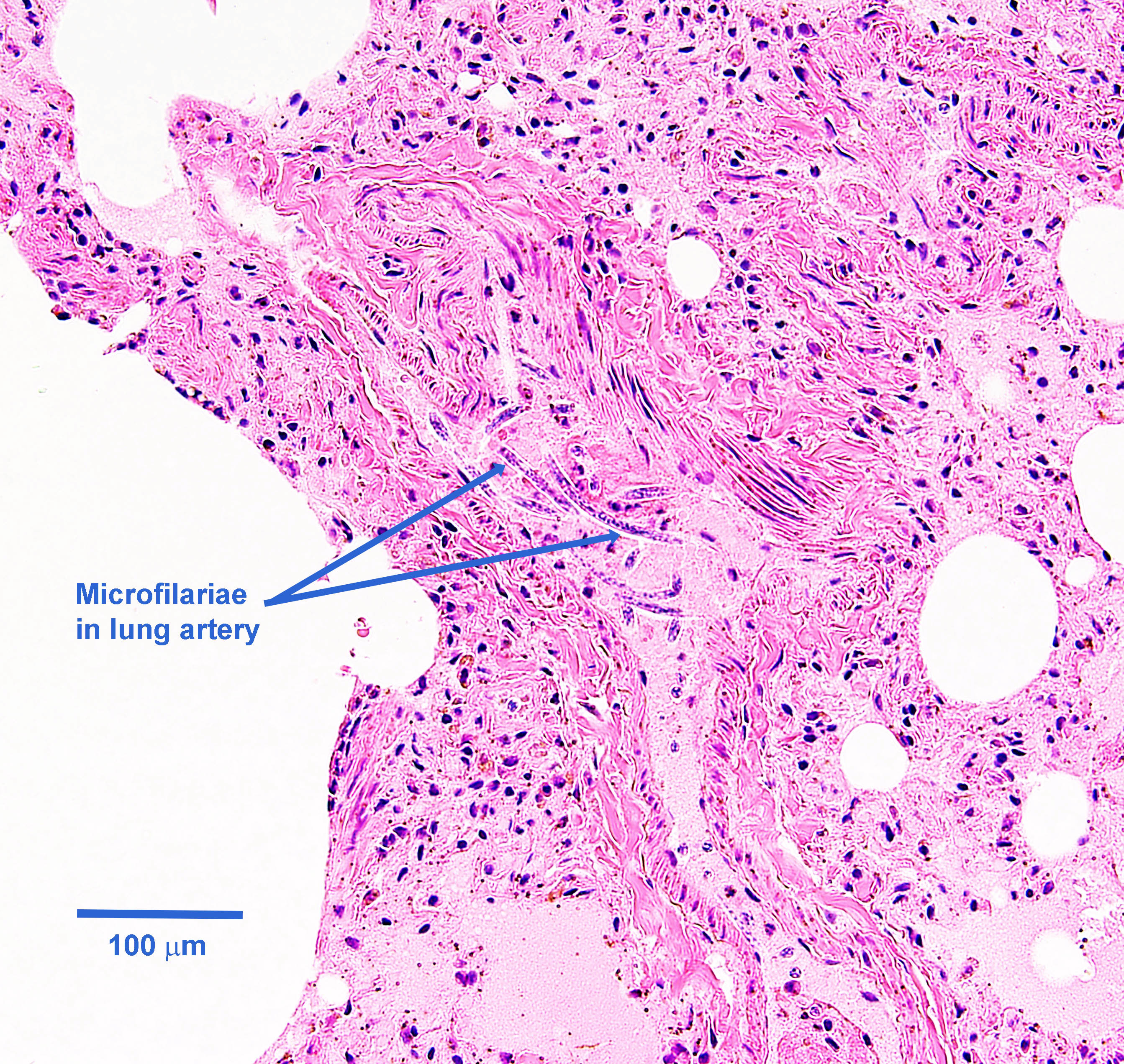 dirofilaria immitis