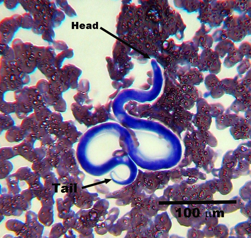 dirofilaria-microfilaria-2021.jpg