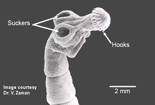 echinococcus-em-scan-2021.jpg