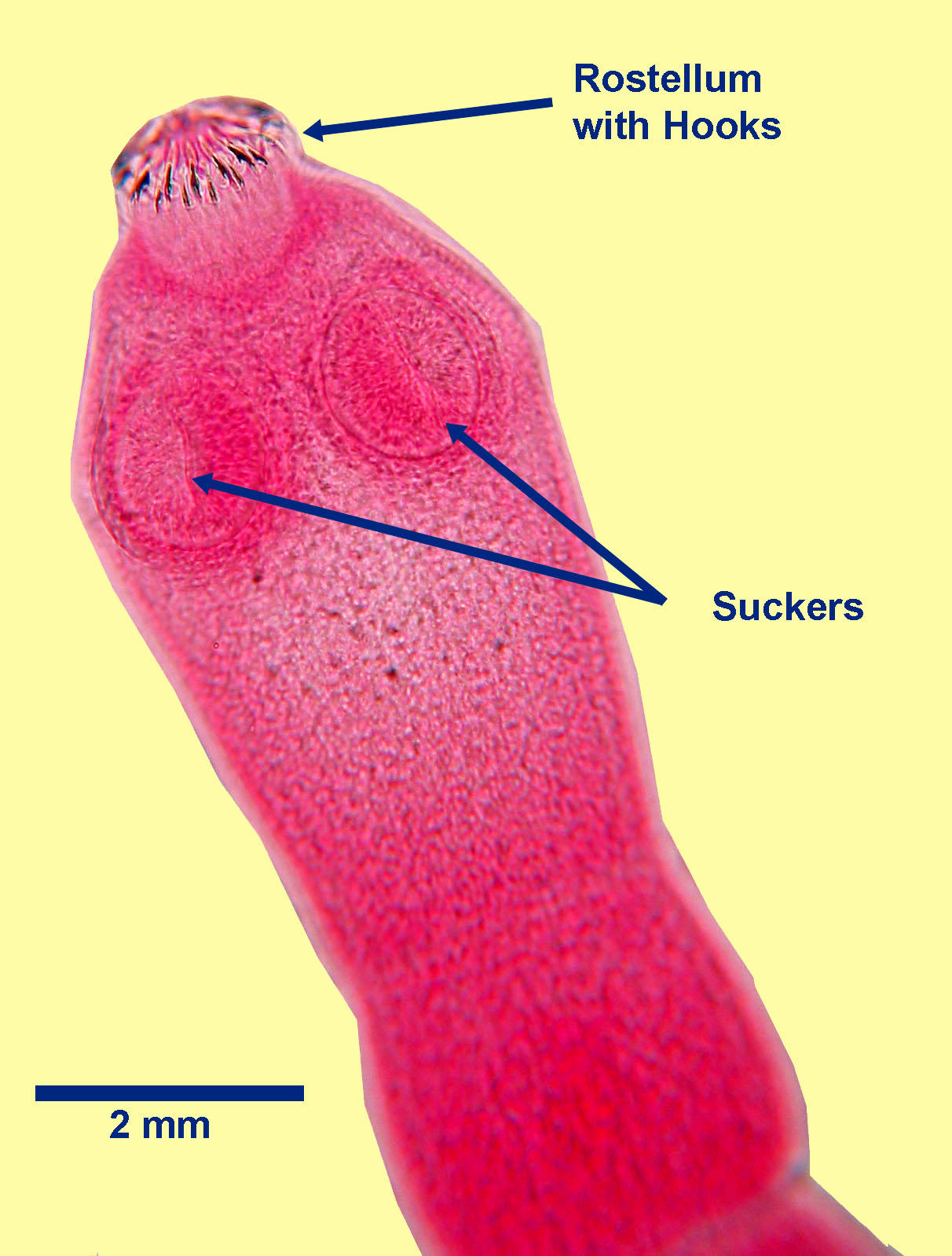 echinococcus-granulosus-scolex-2021.jpg