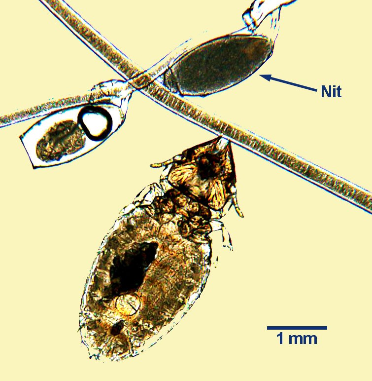 Lice Eggs Under Microscope