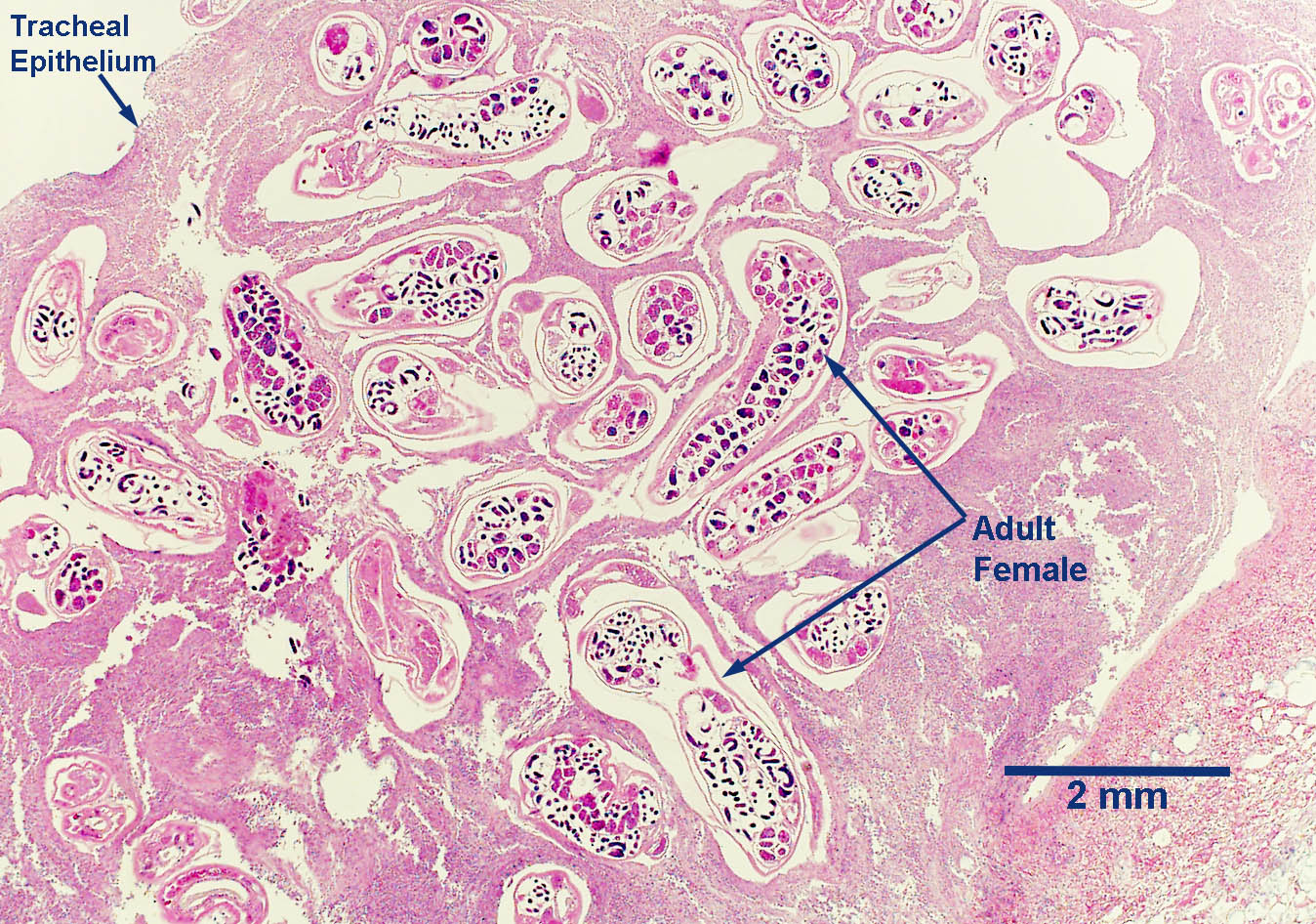 filariodes-nodule-histo-2021.jpg