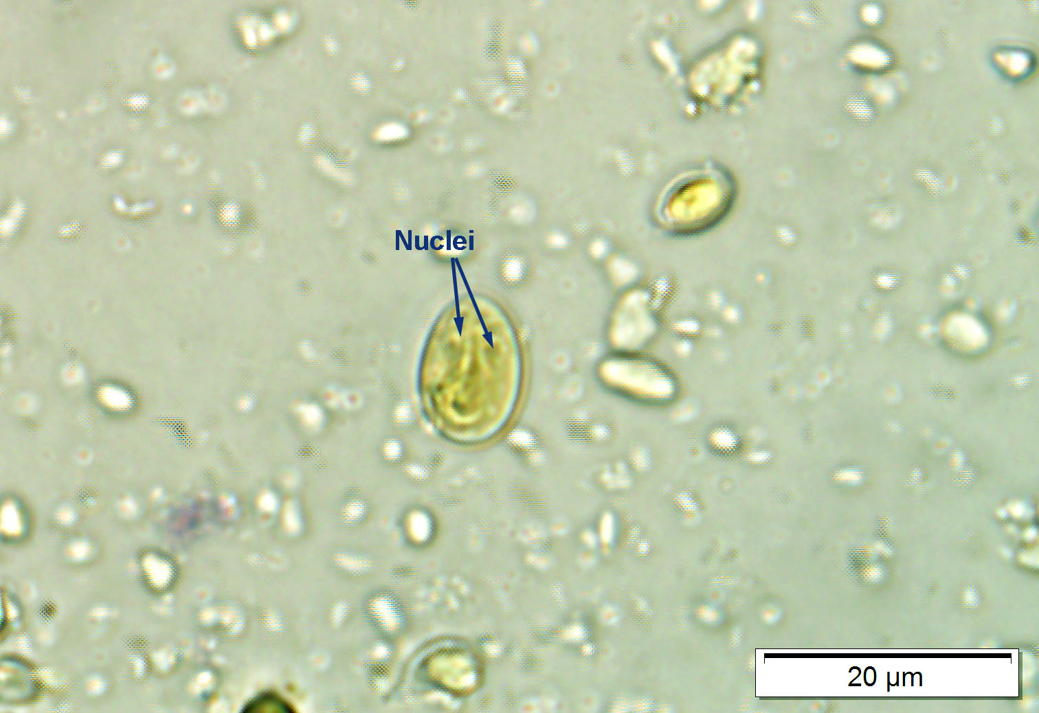 giardia-cysts