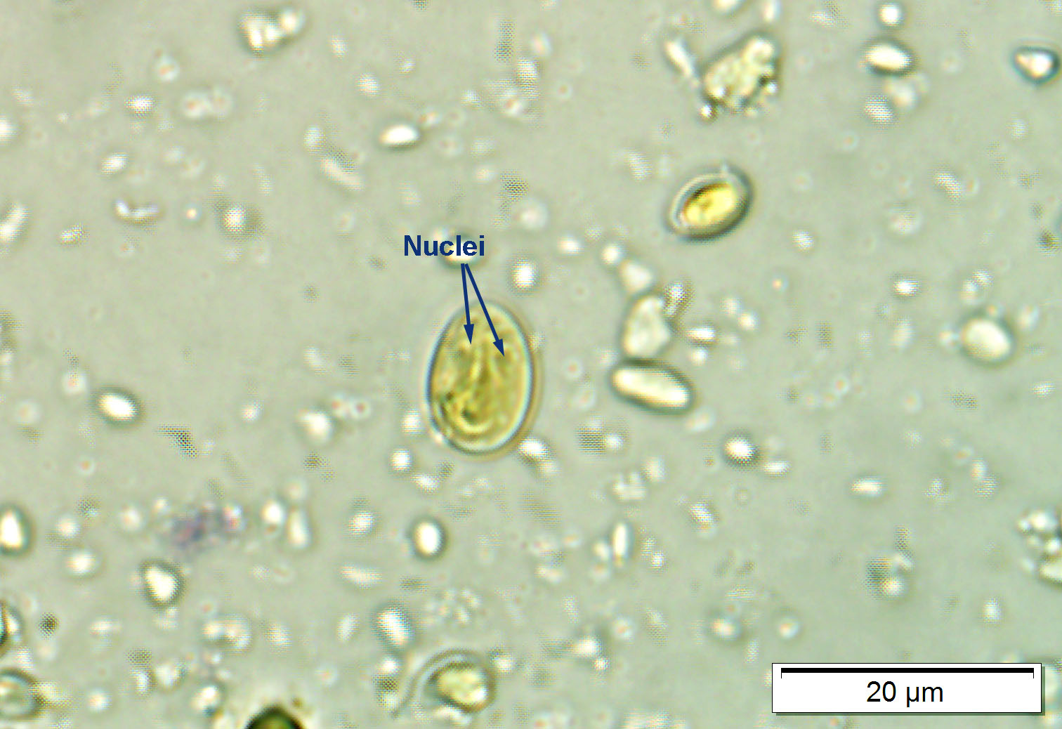 Giardia Cysts