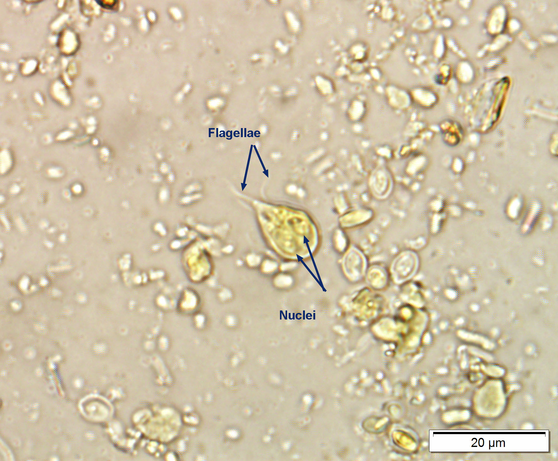 giardia-trophozoite-2021.jpg