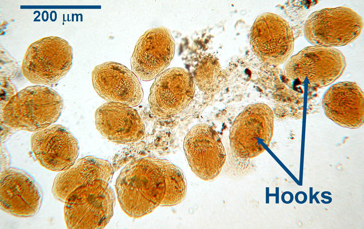 Echinococcus Granulosus Hydatid Sand