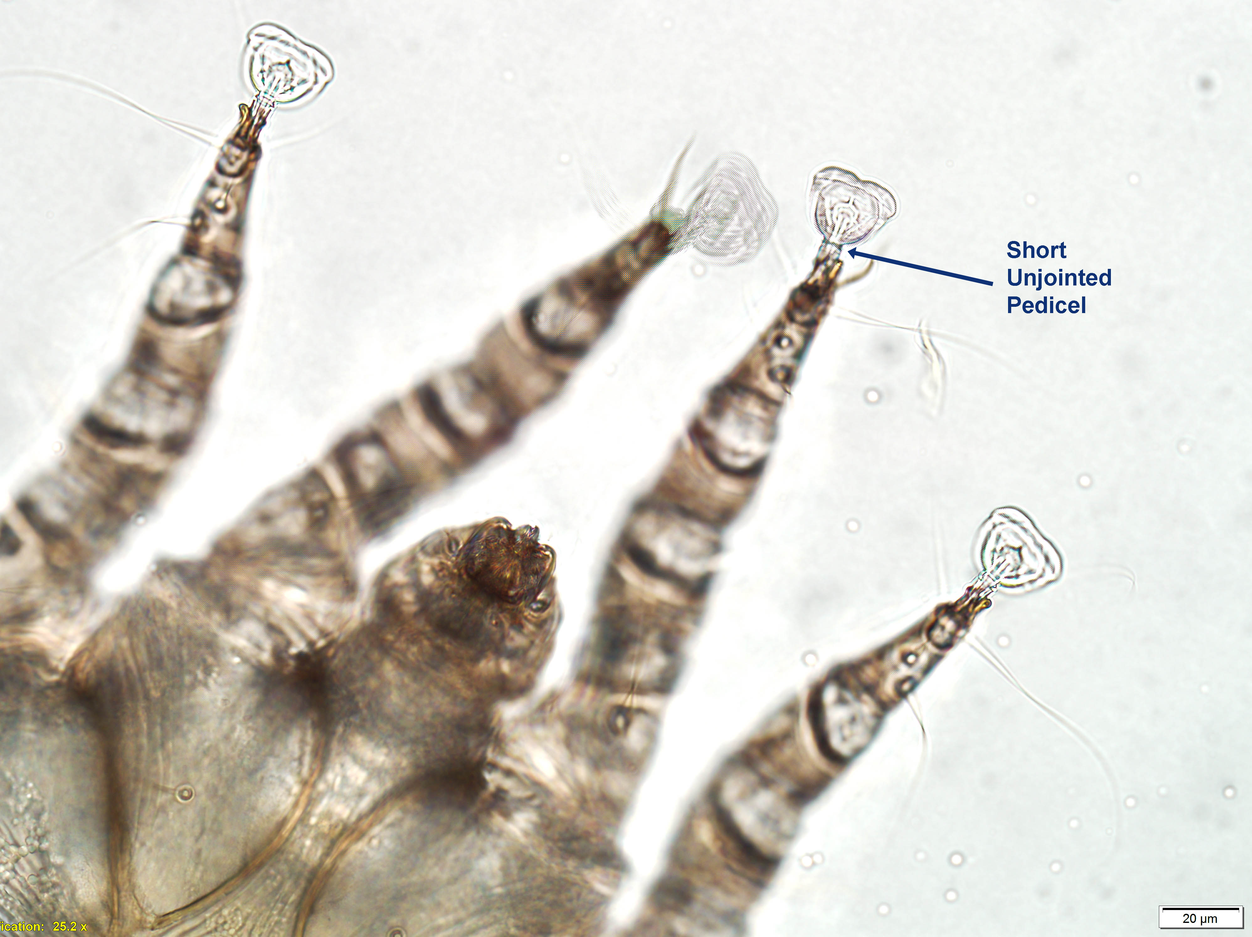 otodectes-pedicel-2021.jpg