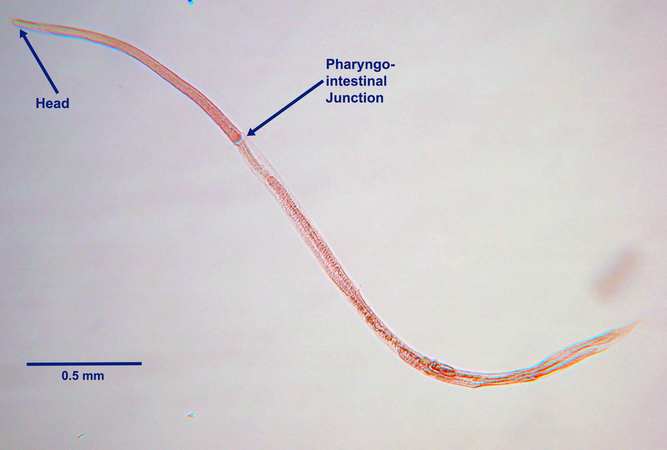 Strongyloides Stercoralis Learn About Parasites Western College Of 