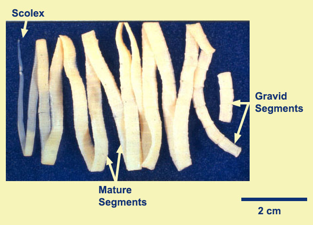 Taenia Tapeworm Segment