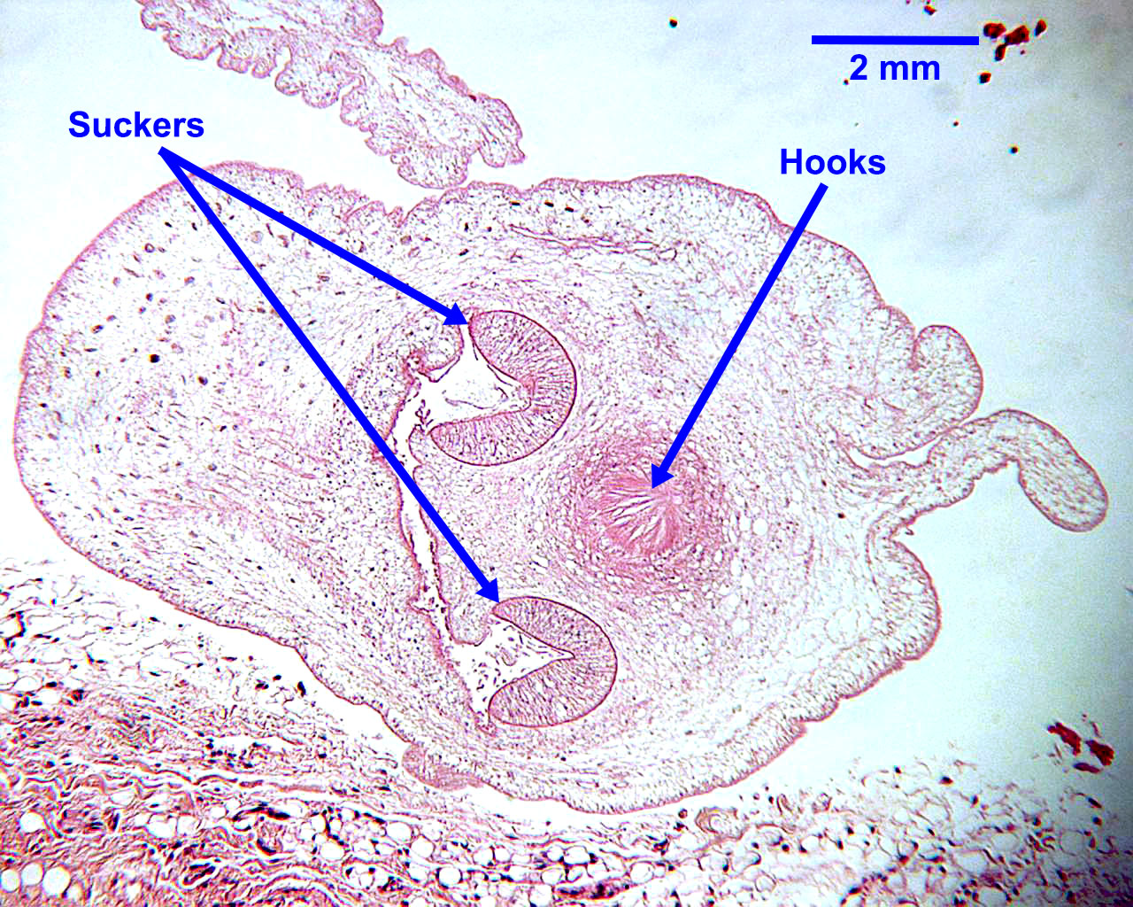 Taenia Solium Cysticercus Taenia Solium Cysticercus