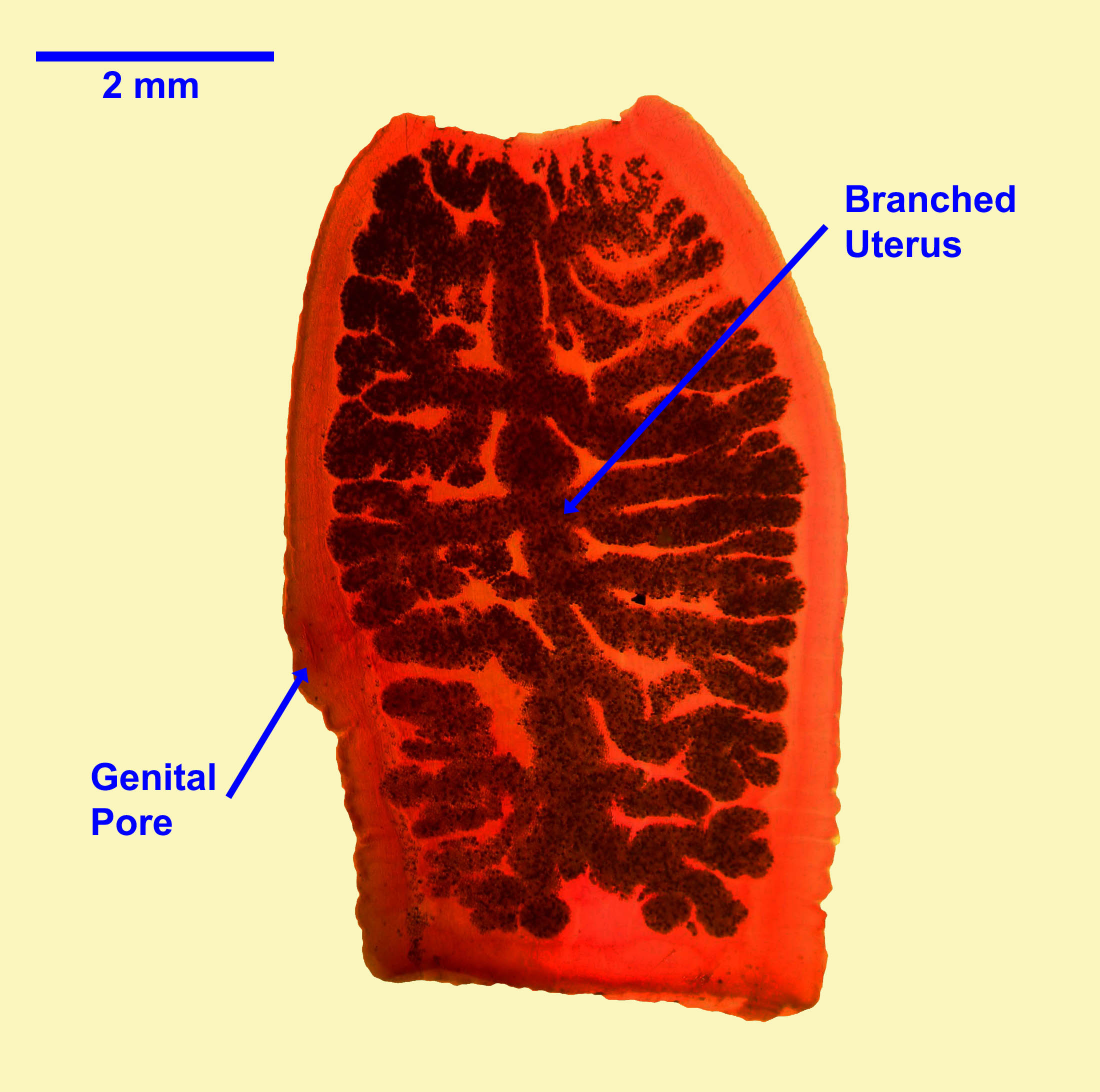 taenia gravid proglottid