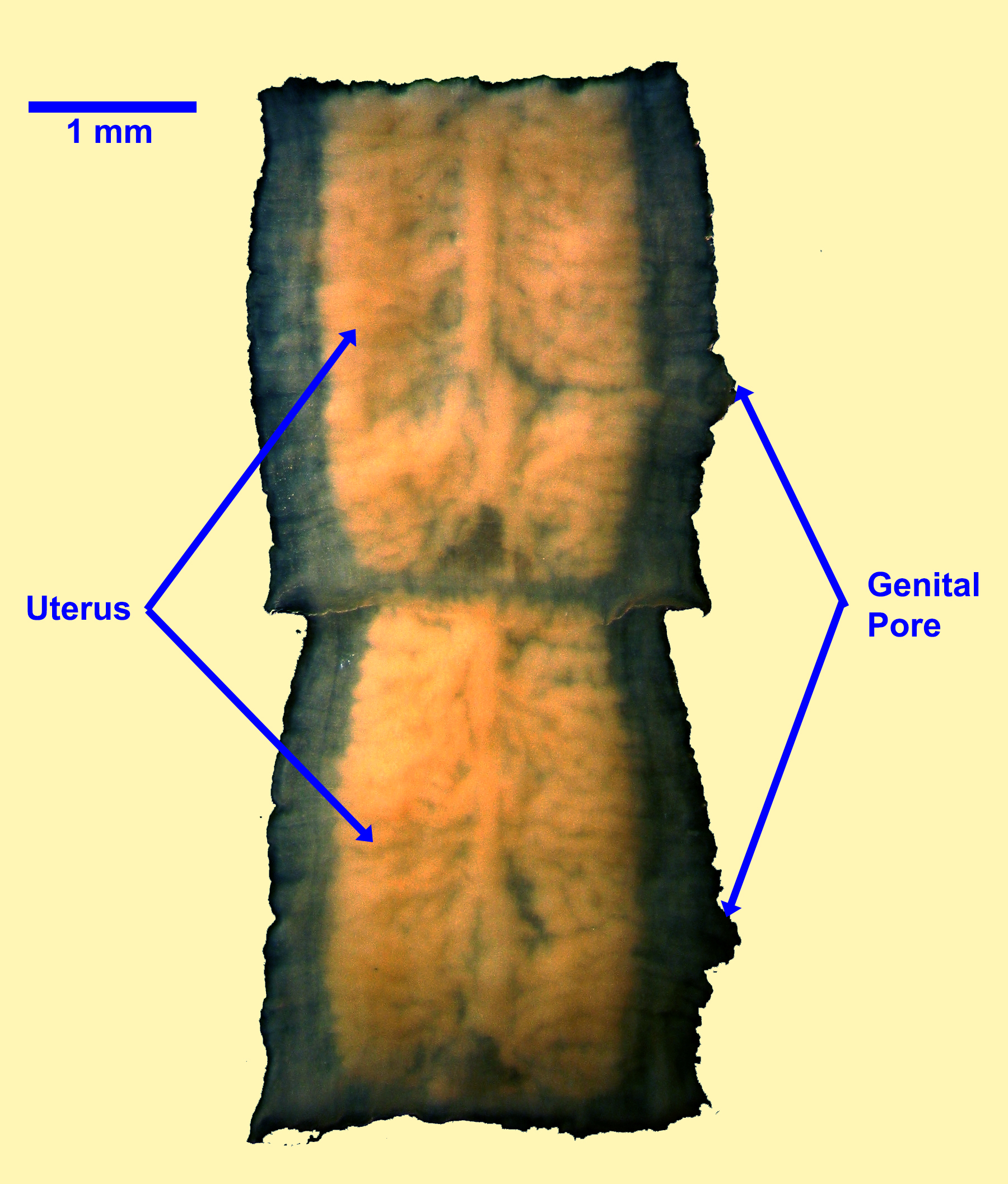 taenia-gravid-unstained-2021.jpg