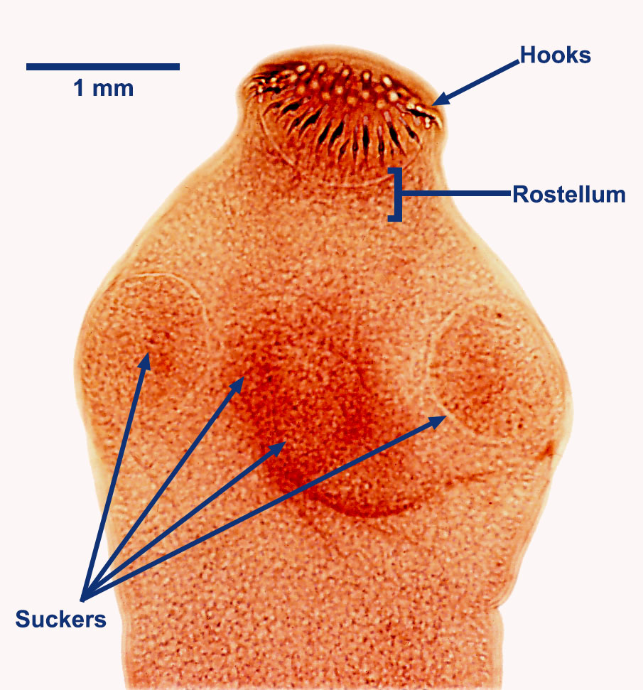 taenia-scolex-stained-2021.jpg