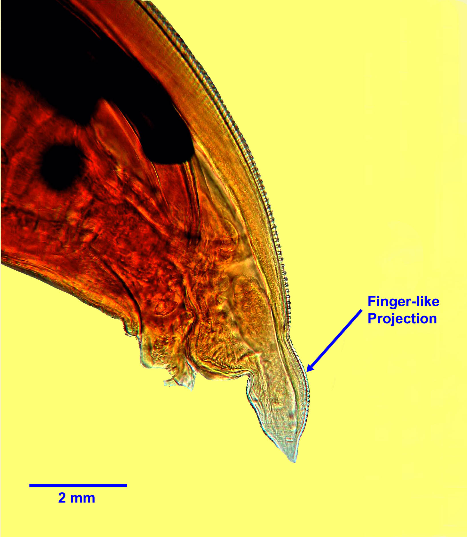 toxocara-canis-tail-projection-2021.jpg