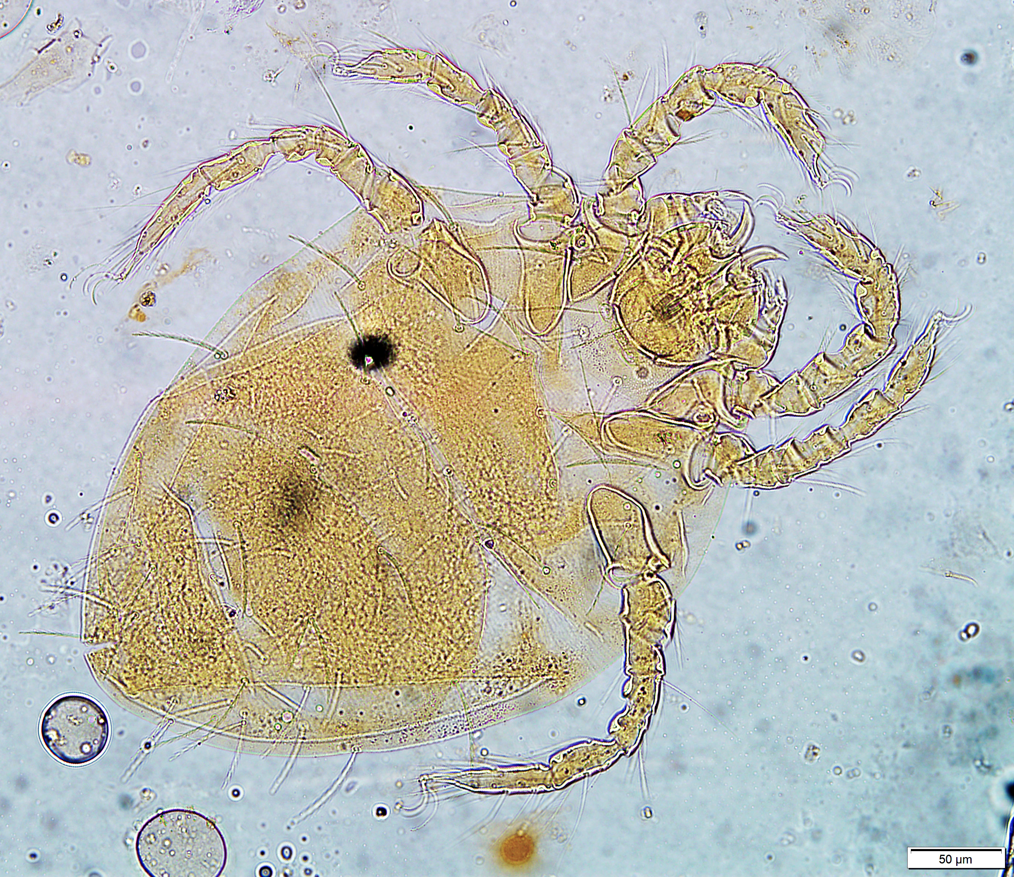 trombicula-larvae-2021.jpg