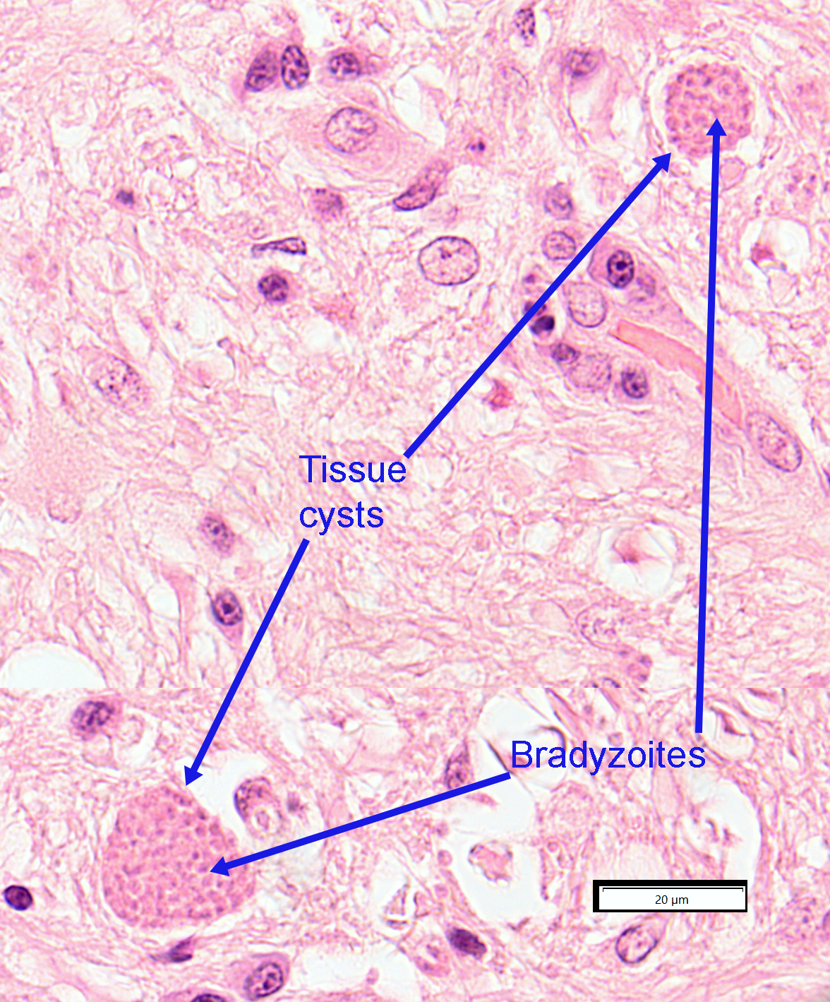 toxo-tissue-cyst-2021.jpg