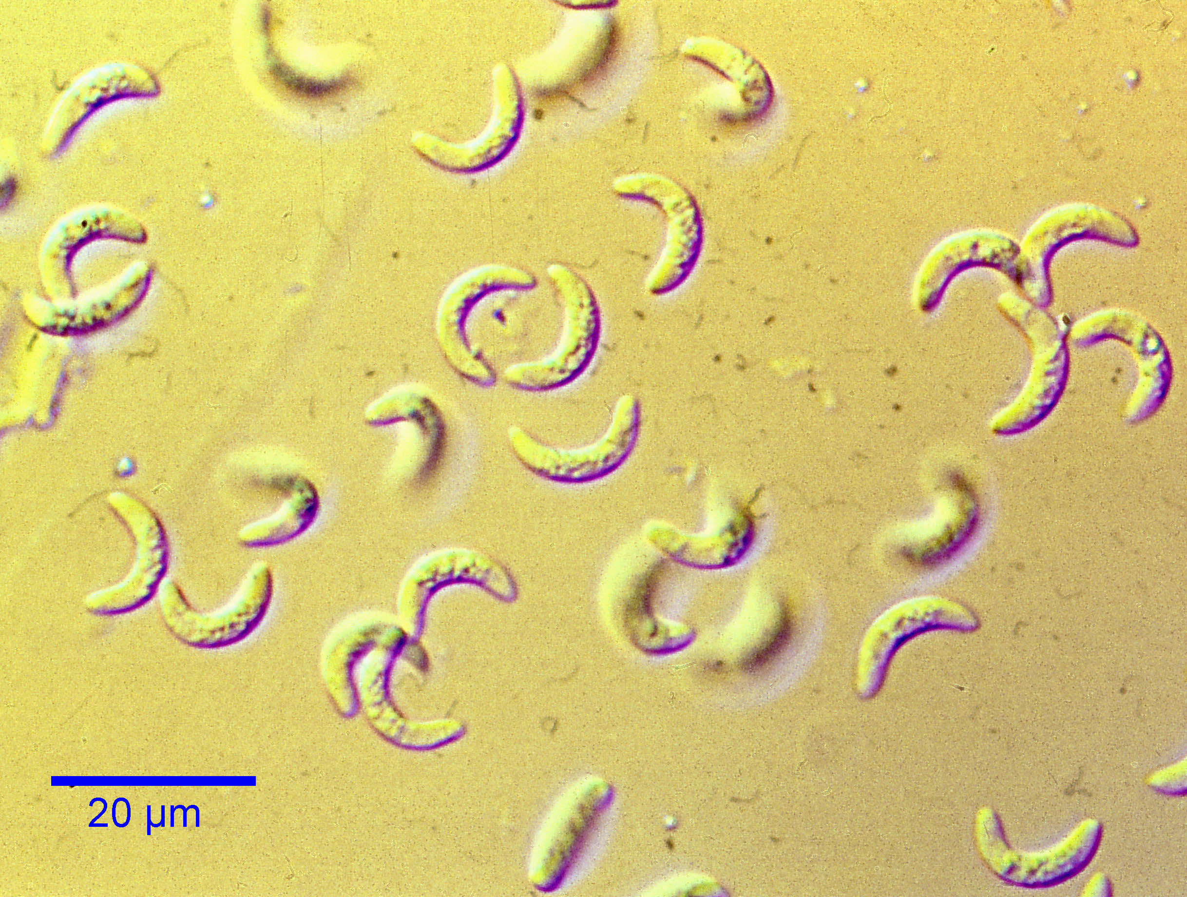 toxoplasma-bradyzoites-loose.jpg