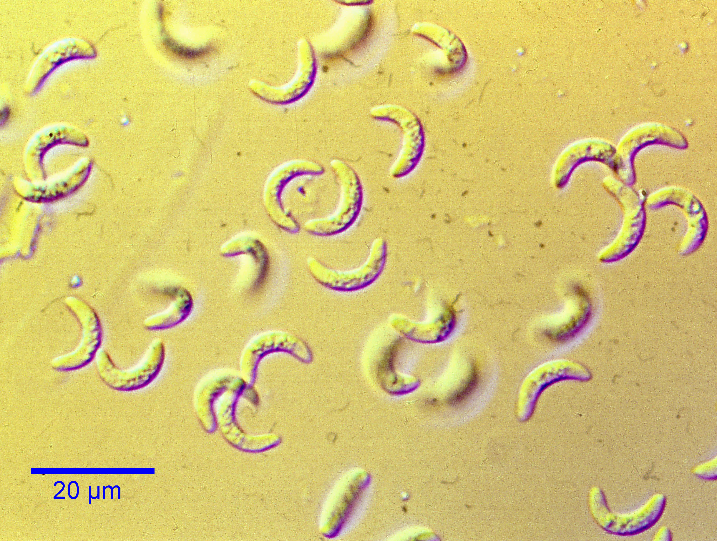 toxoplasma gondii oocyst