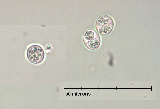 toxoplasma gondii oocyst